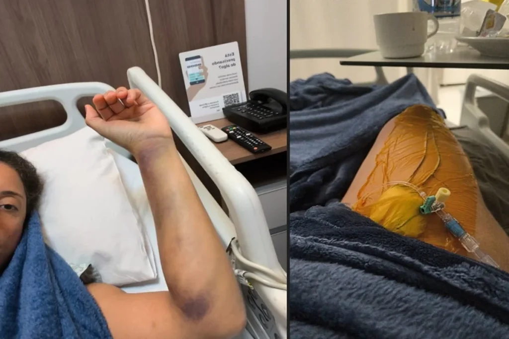 Brasiliense desenvolve tromboembolismo pulmonar após voo de curta duração