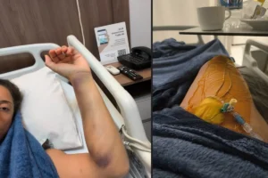 Brasiliense desenvolve tromboembolismo pulmonar após voo de curta duração
