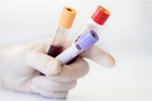 TST condena empresa a indenizar trabalhadora por coleta de sangue sem autorização